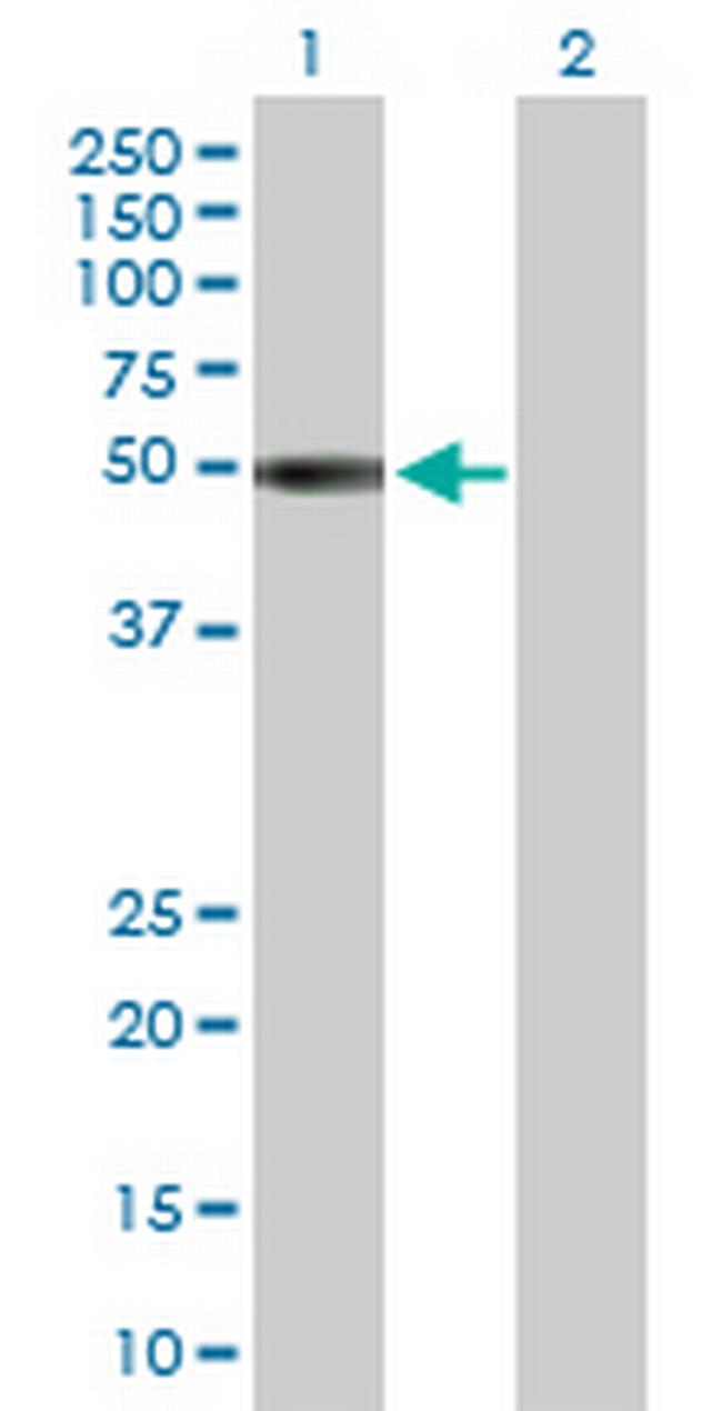 KIR2DL1 Antibody in Western Blot (WB)