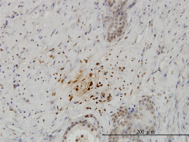 KISS1 Antibody in Immunohistochemistry (Paraffin) (IHC (P))