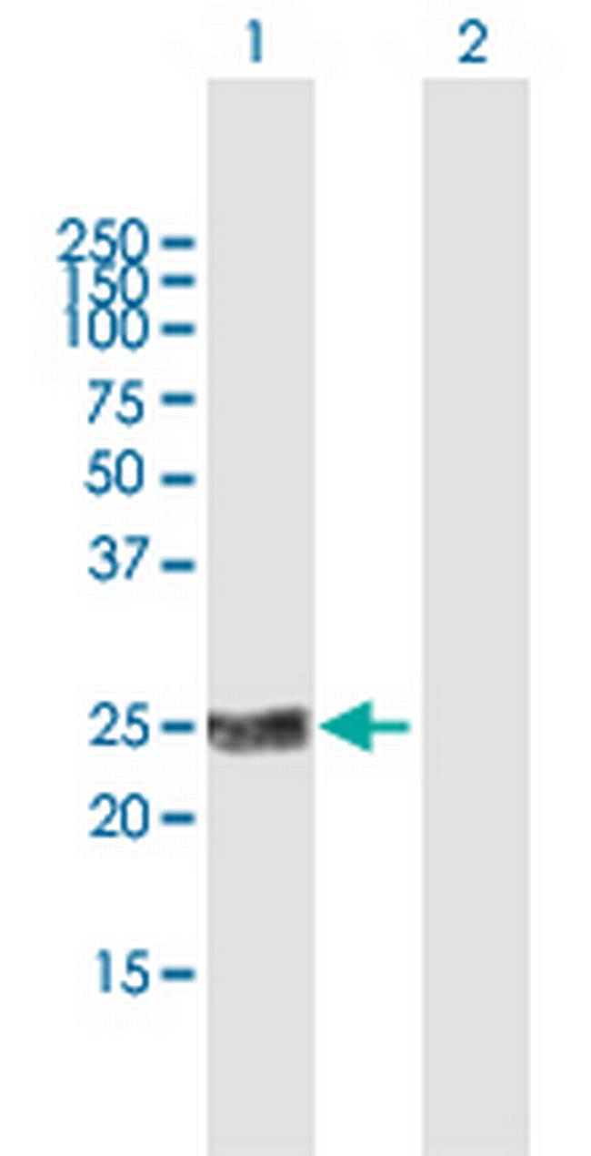 KLK2 Antibody in Western Blot (WB)