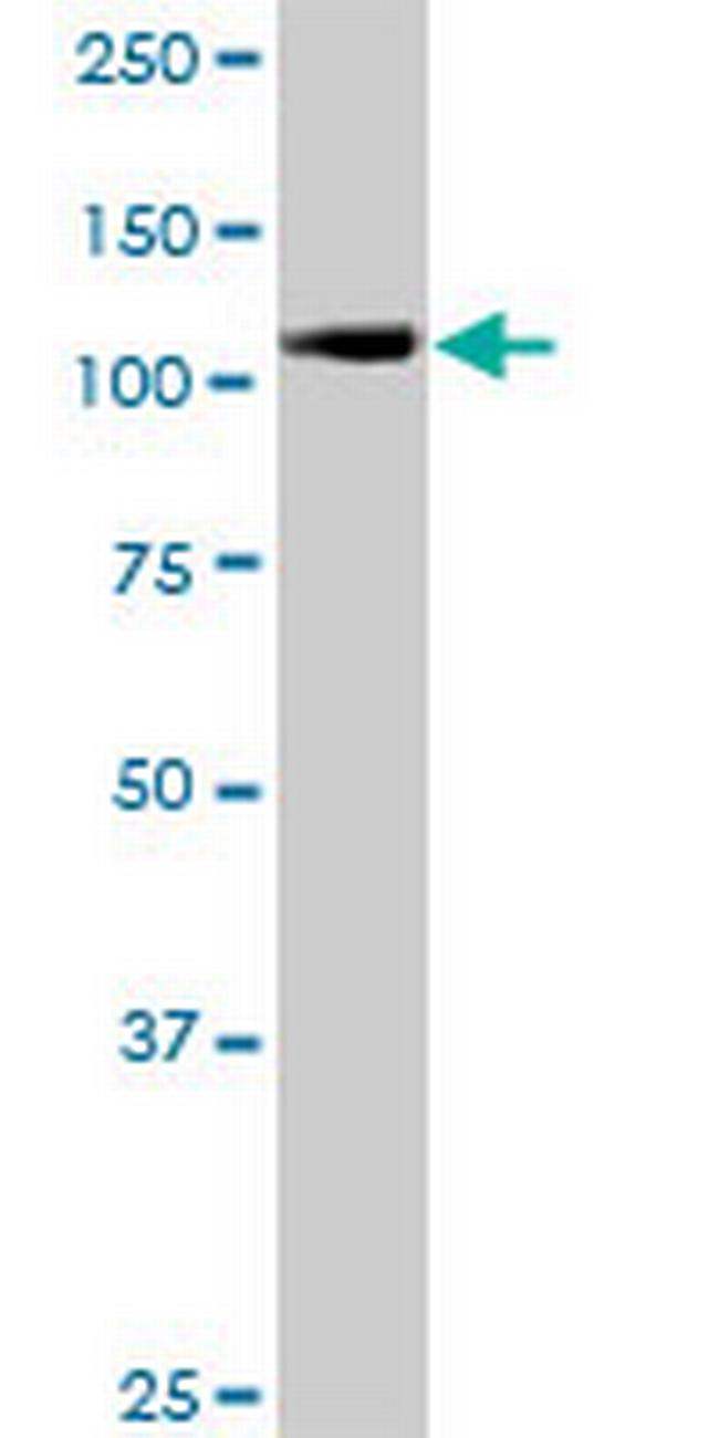 RANBP5 Antibody in Western Blot (WB)