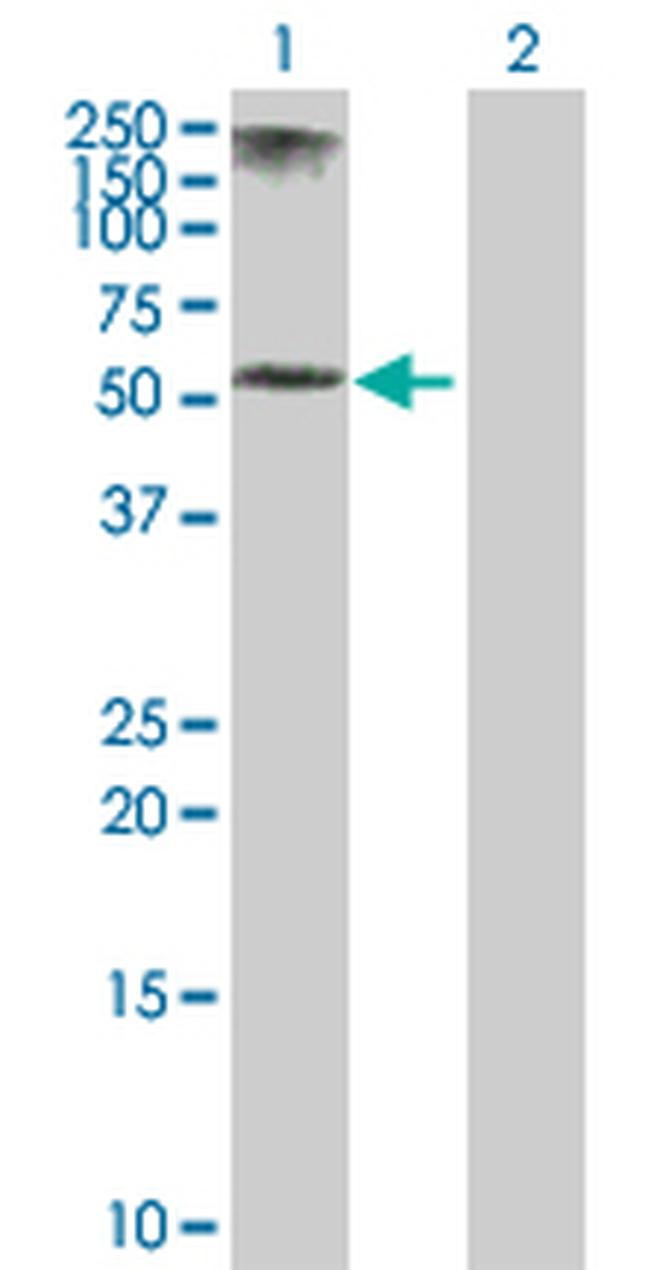 KRT5 Antibody in Western Blot (WB)