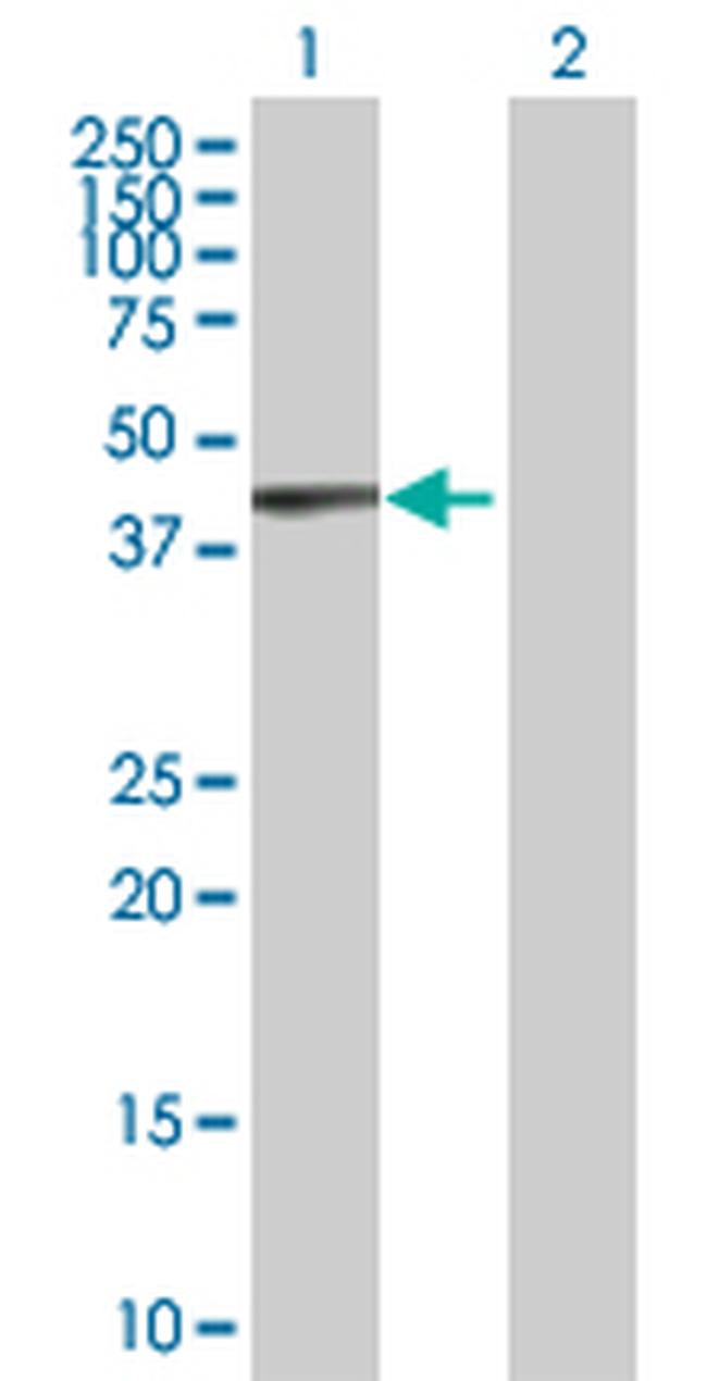 KRT17 Antibody in Western Blot (WB)