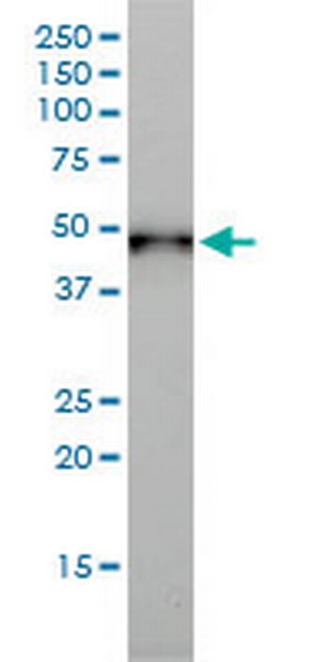 KRT17 Antibody in Western Blot (WB)