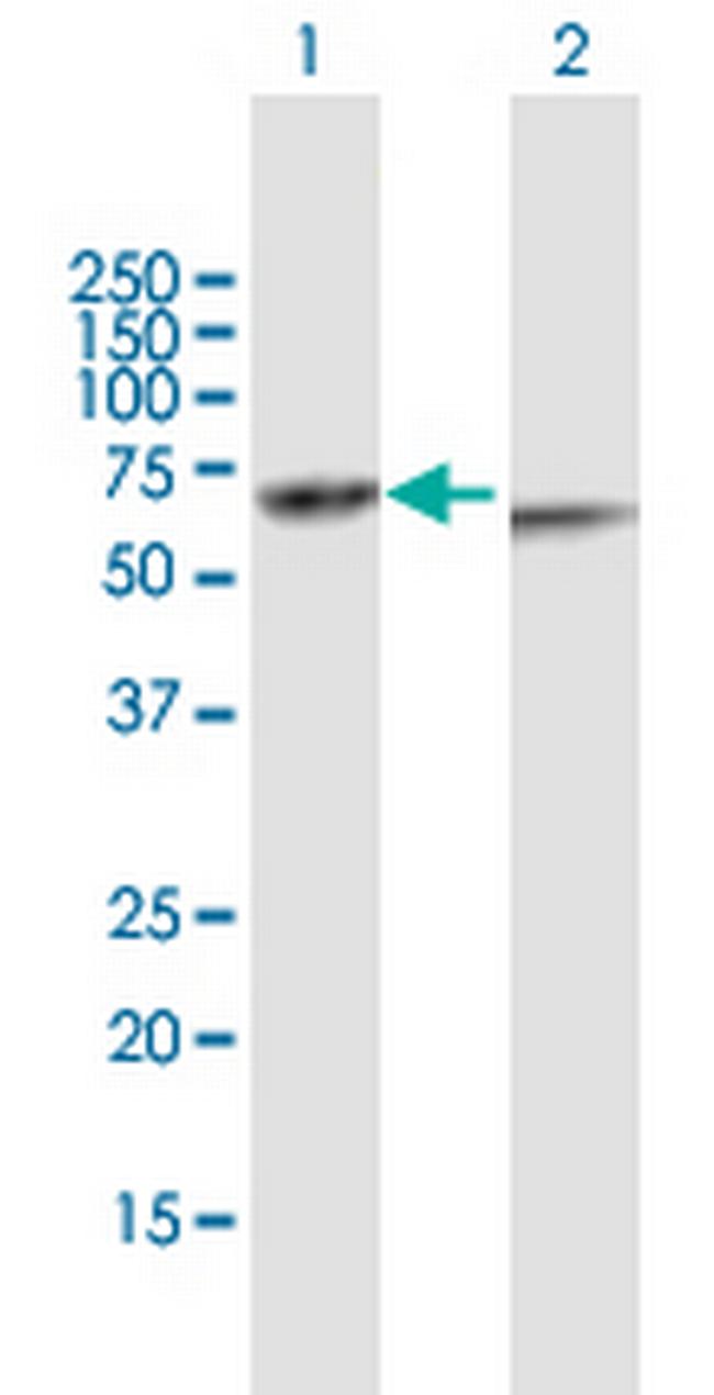 KRT82 Antibody in Western Blot (WB)