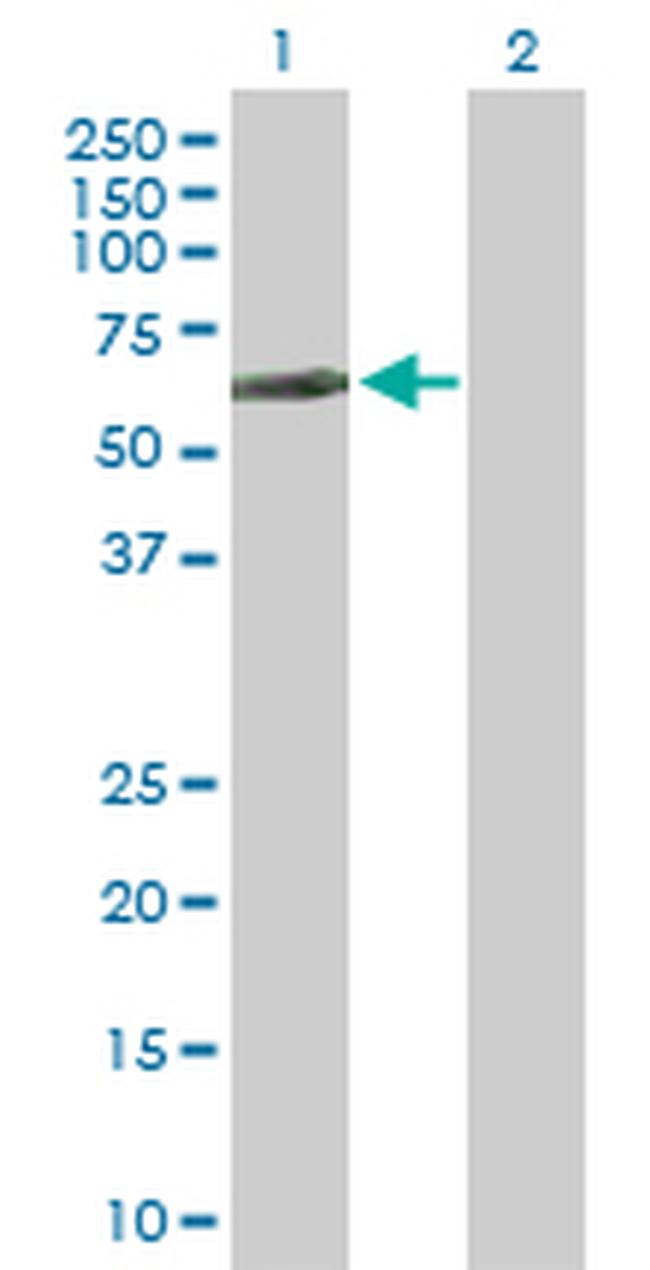 LCK Antibody in Western Blot (WB)