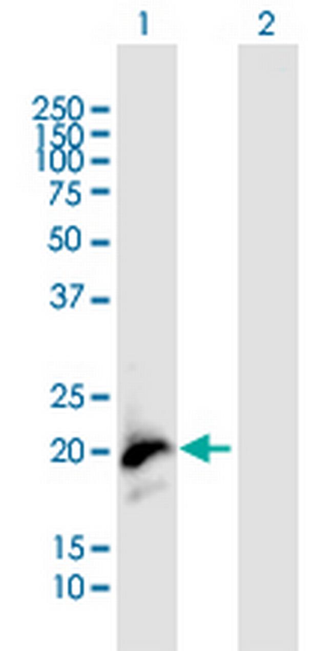 LCN2 Antibody in Western Blot (WB)