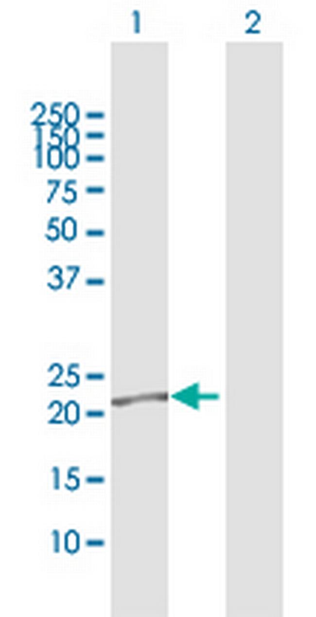 LCN2 Antibody in Western Blot (WB)