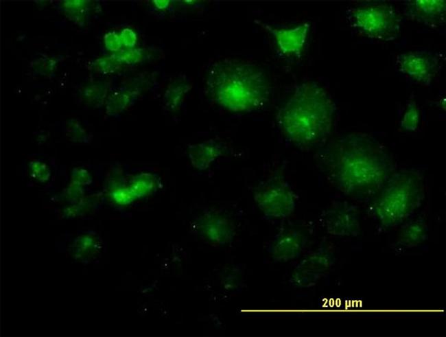 LFNG Antibody in Immunocytochemistry (ICC/IF)