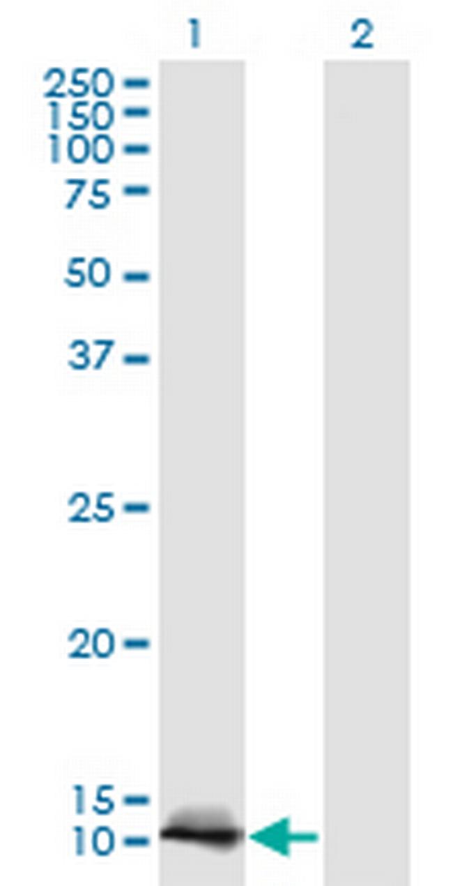 LGALS1 Antibody in Western Blot (WB)