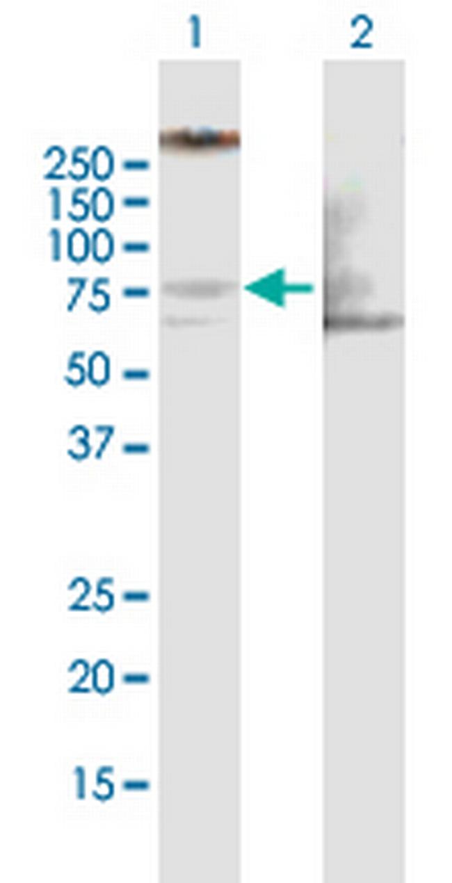 LIMK1 Antibody in Western Blot (WB)