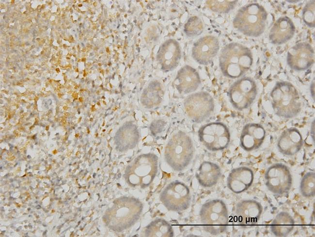 LIMK1 Antibody in Immunohistochemistry (Paraffin) (IHC (P))