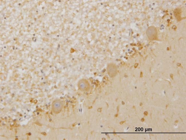 LIMK1 Antibody in Immunohistochemistry (Paraffin) (IHC (P))