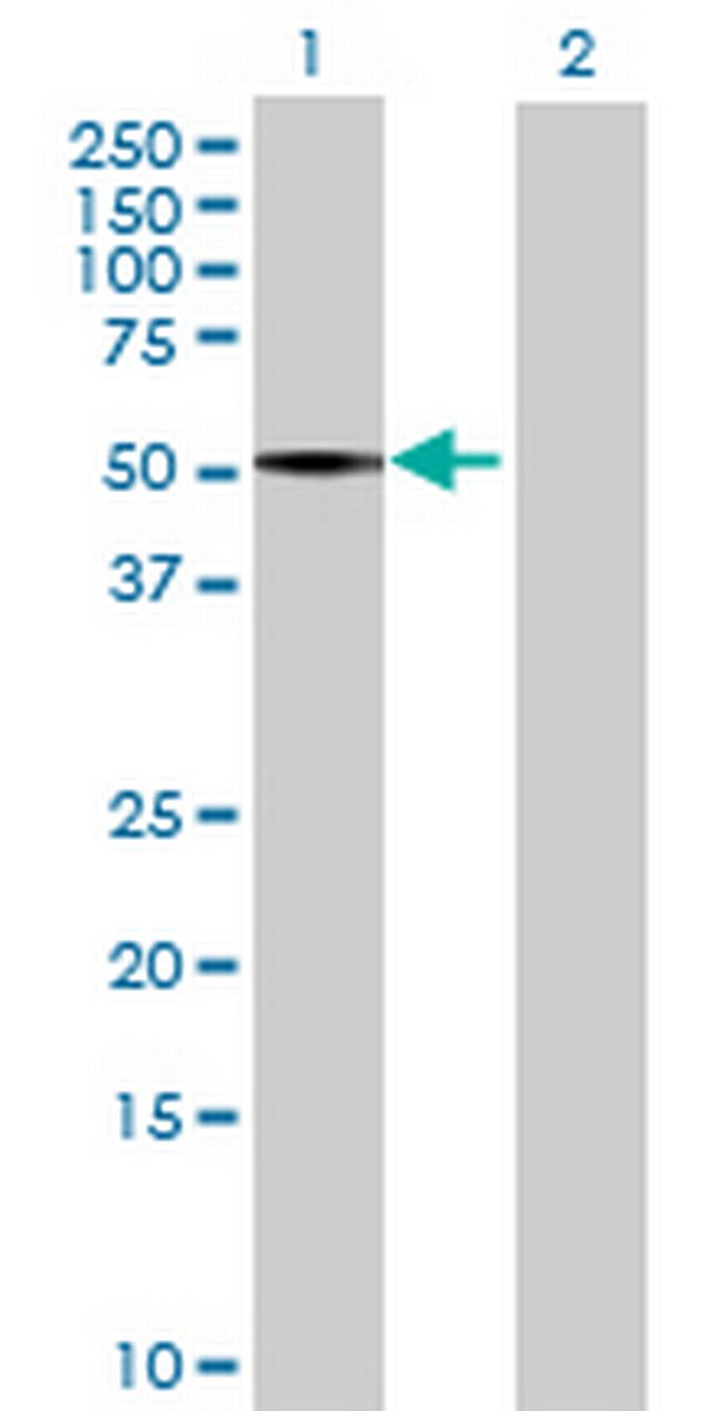 FADS1 Antibody in Western Blot (WB)