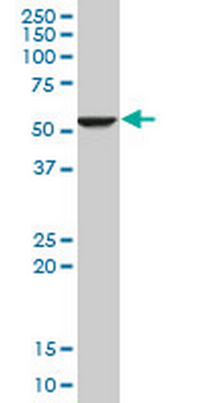 FADS1 Antibody in Western Blot (WB)