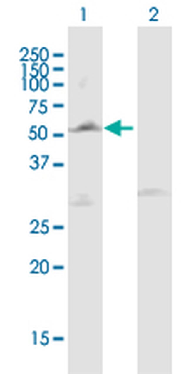 LPL Antibody in Western Blot (WB)