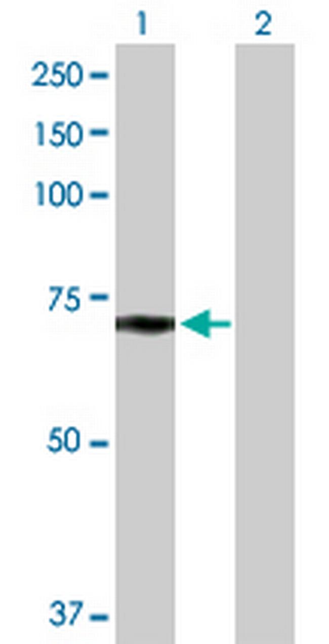 LPL Antibody in Western Blot (WB)