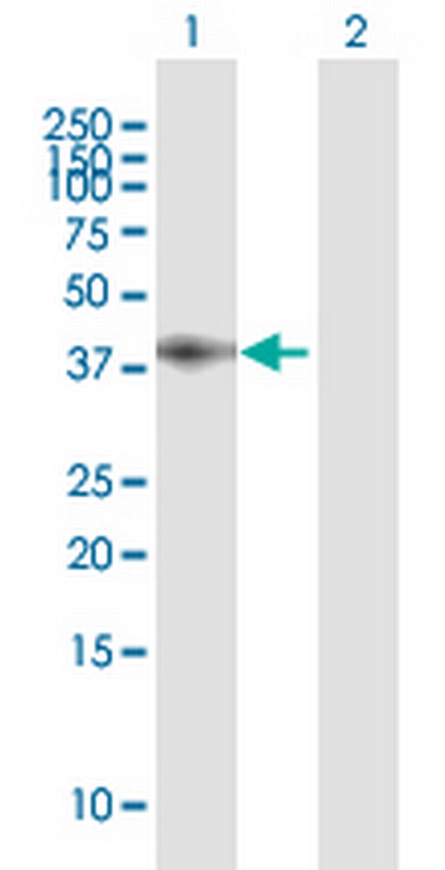 LRP1 Antibody in Western Blot (WB)