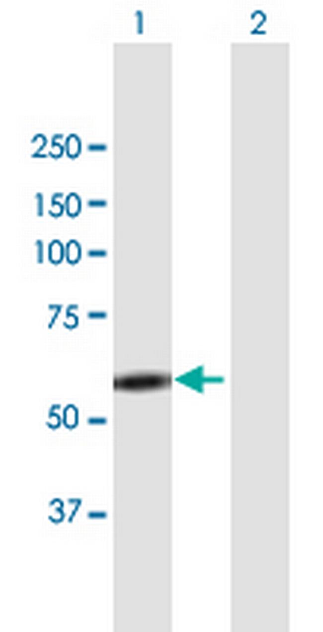 LYN Antibody in Western Blot (WB)