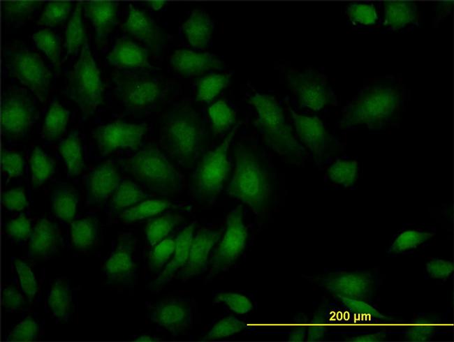 SMAD1 Antibody in Immunocytochemistry (ICC/IF)