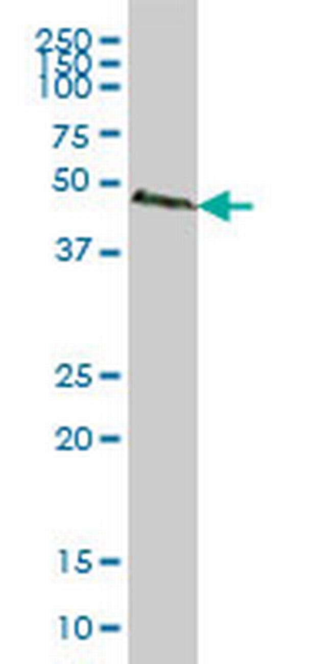 SMAD2 Antibody in Western Blot (WB)