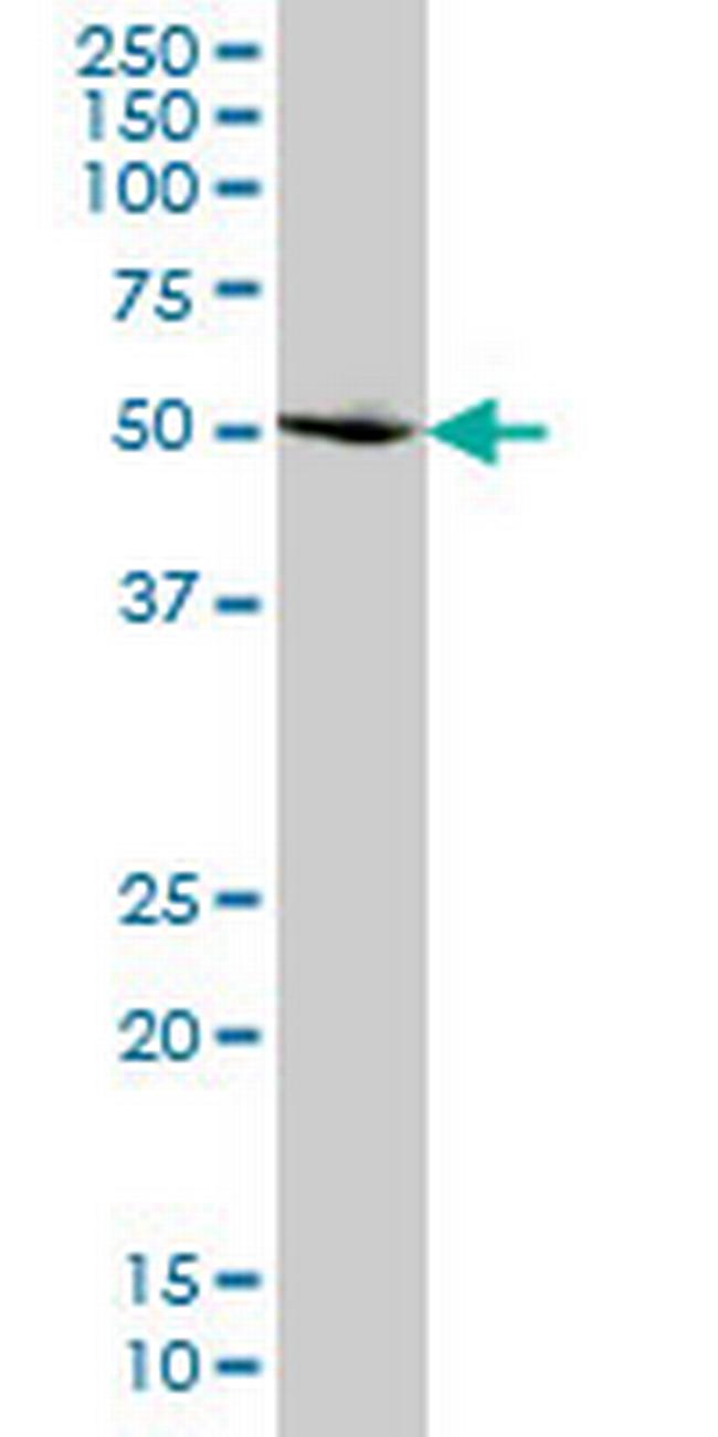 SMAD2 Antibody in Western Blot (WB)