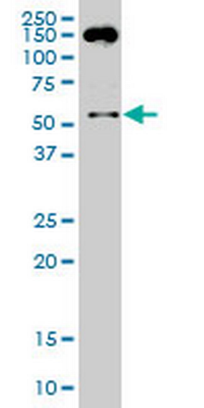 SMAD2 Antibody in Western Blot (WB)