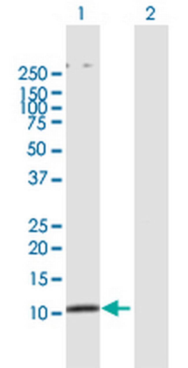 SMAD3 Antibody in Western Blot (WB)