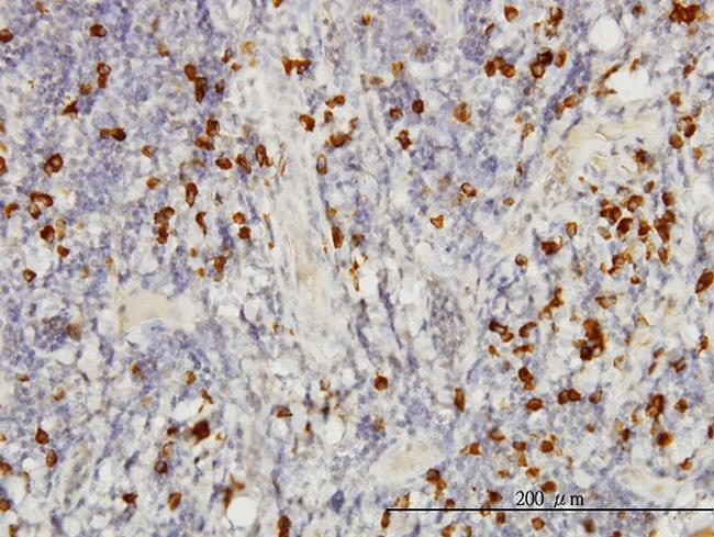 SMAD3 Antibody in Immunohistochemistry (Paraffin) (IHC (P))