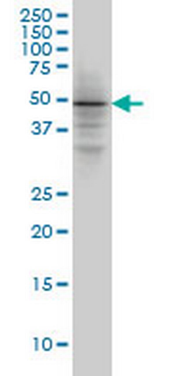 SMAD3 Antibody in Western Blot (WB)