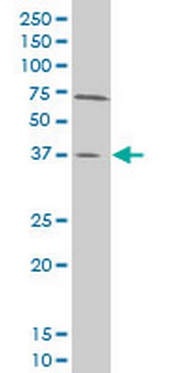 SMAD3 Antibody in Western Blot (WB)