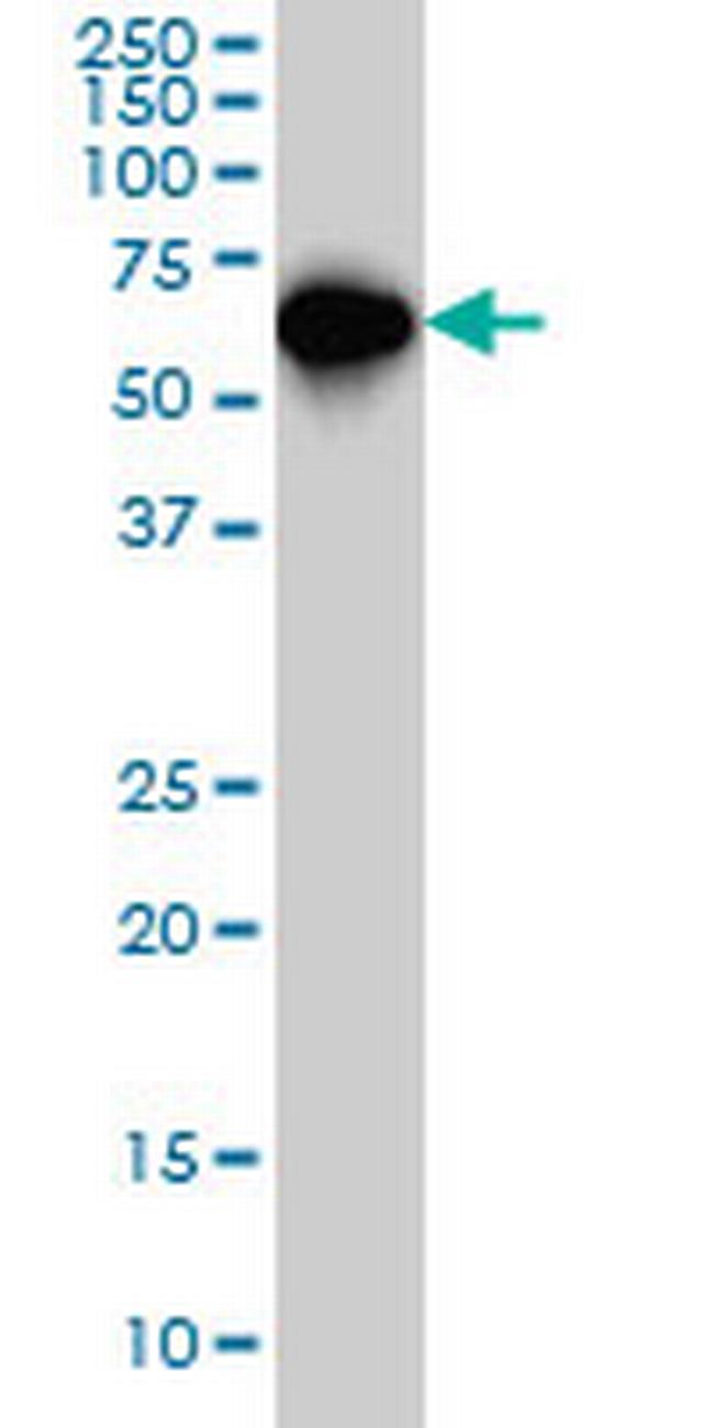 SMAD4 Antibody in Western Blot (WB)