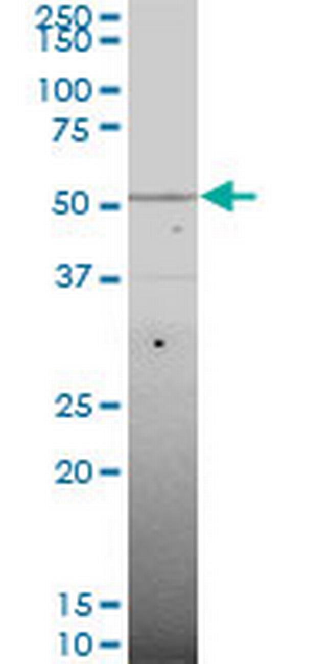 SMAD6 Antibody in Western Blot (WB)