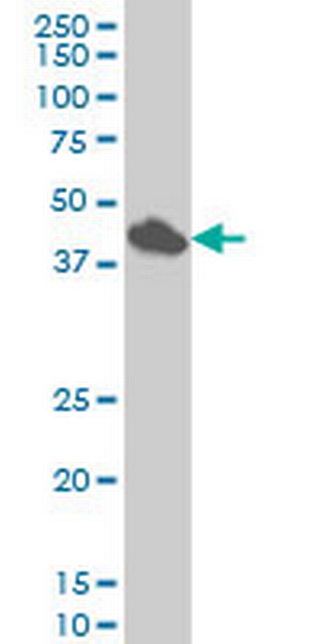 SMAD7 Antibody in Western Blot (WB)