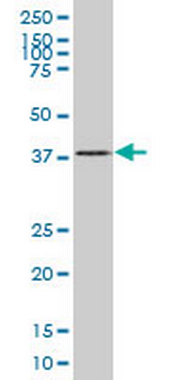 SMAD7 Antibody in Western Blot (WB)