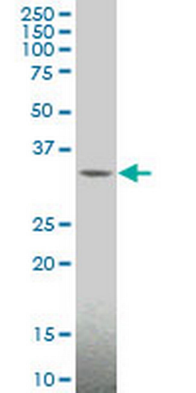 MAGEA4 Antibody in Western Blot (WB)