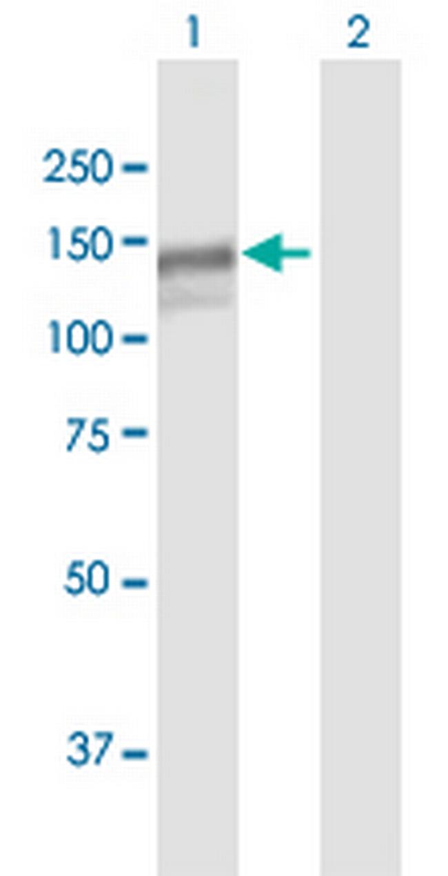 MAN2B1 Antibody in Western Blot (WB)