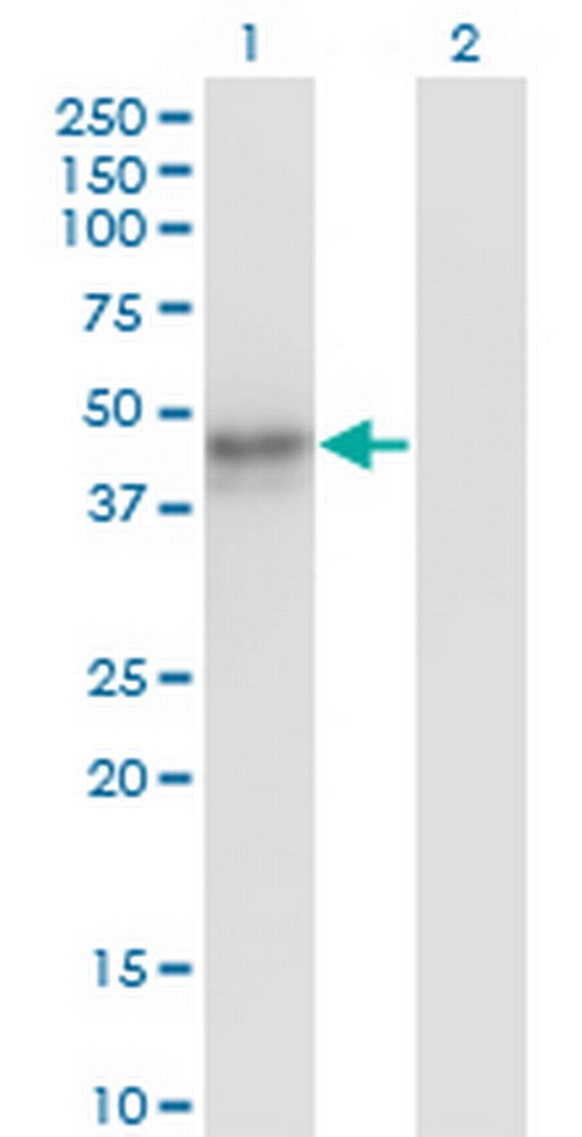 MAT1A Antibody in Western Blot (WB)