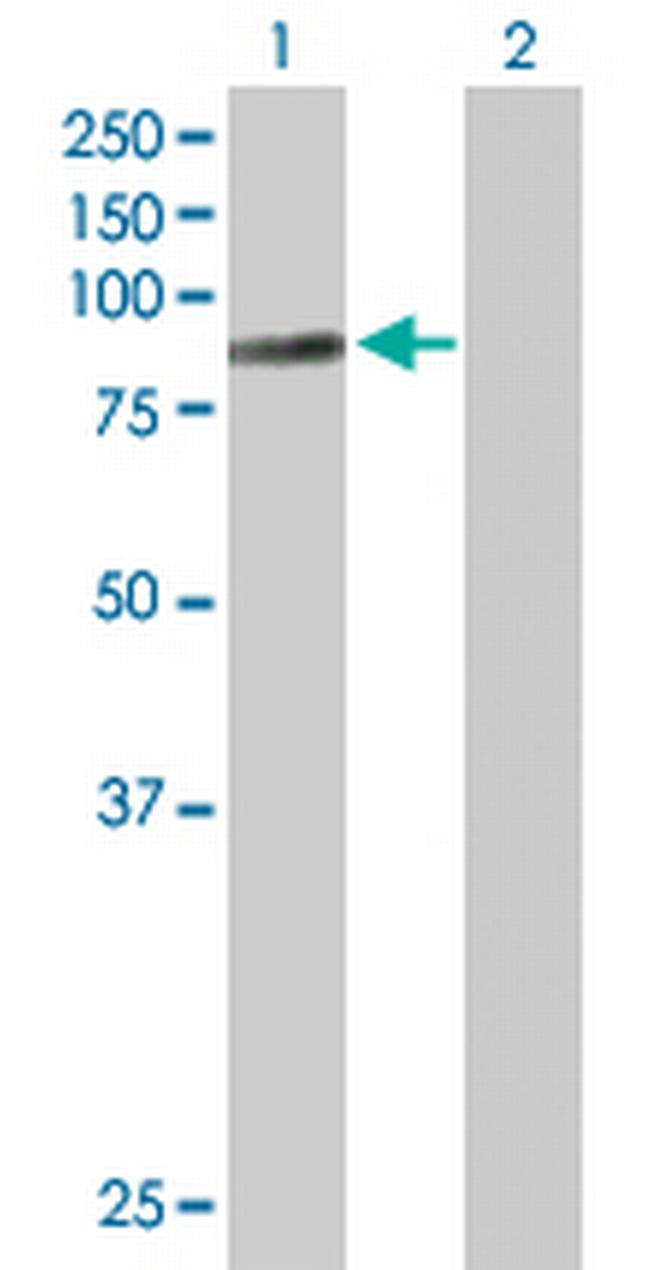 MBD1 Antibody in Western Blot (WB)