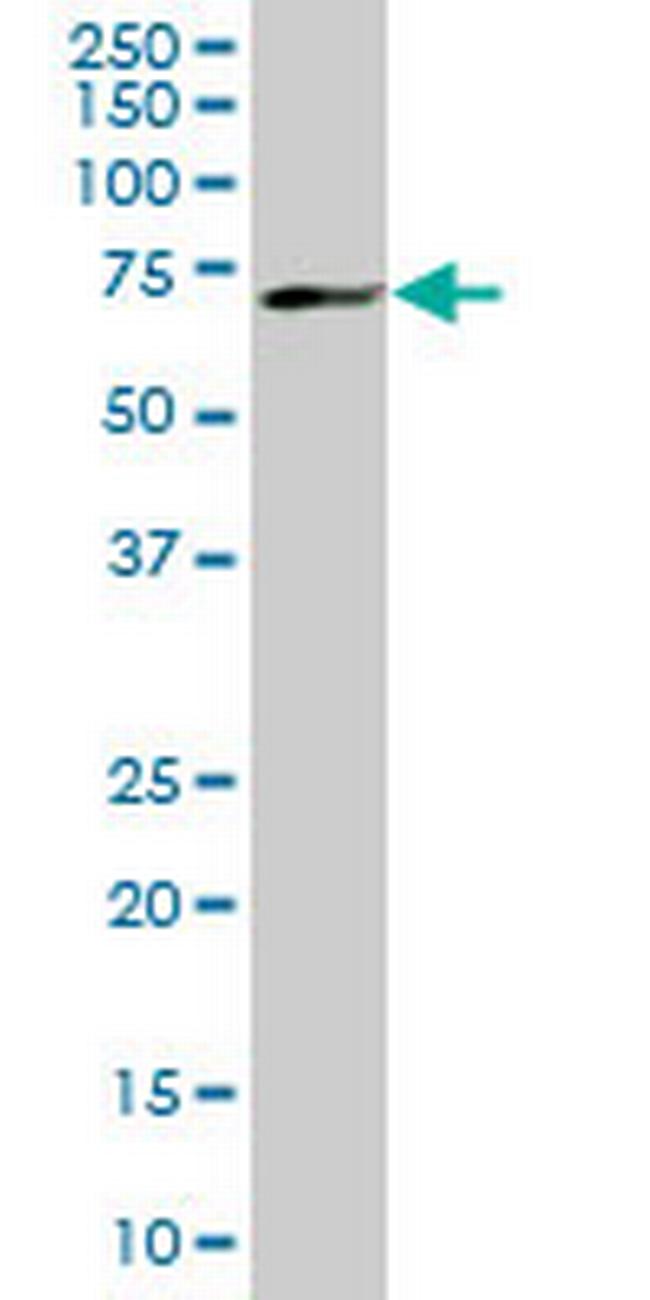 MBD1 Antibody in Western Blot (WB)