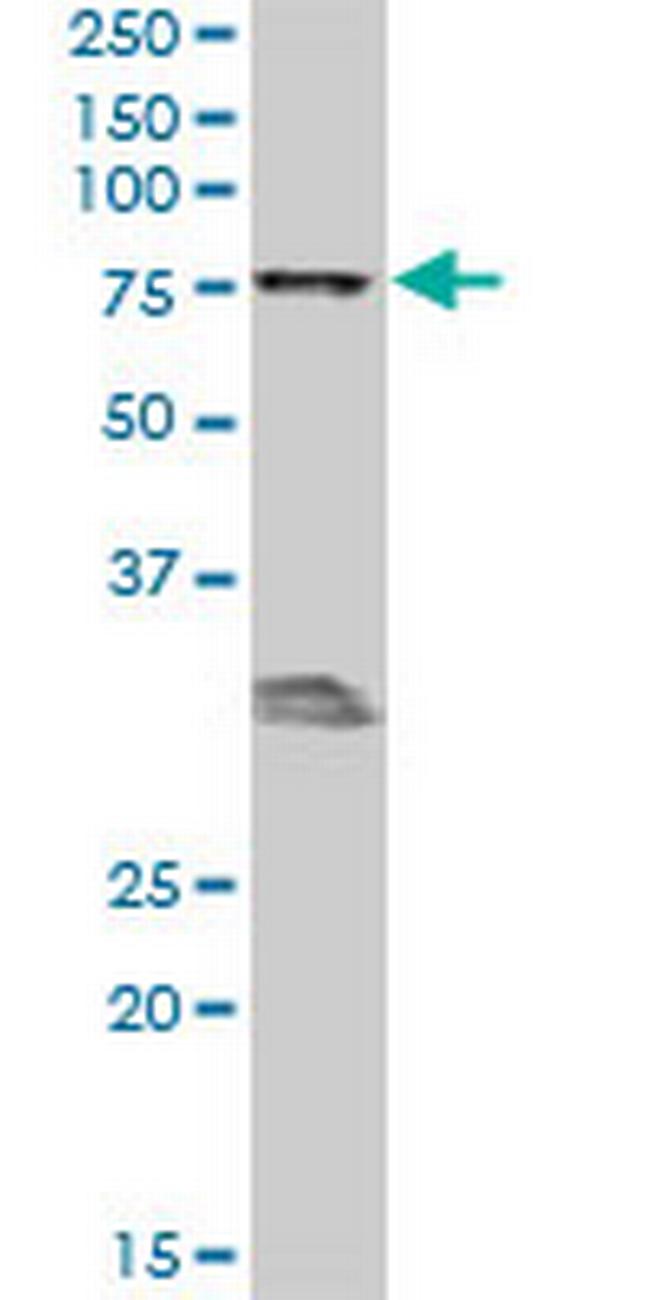 MBD1 Antibody in Western Blot (WB)