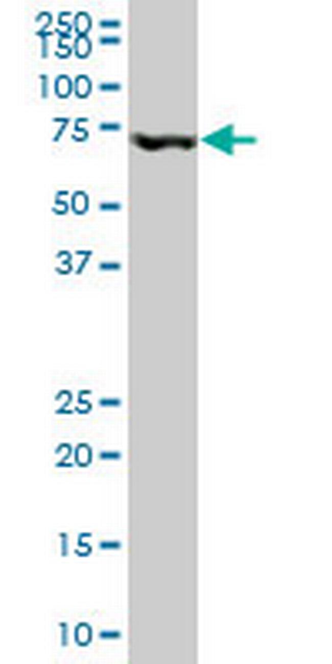 MBD1 Antibody in Western Blot (WB)