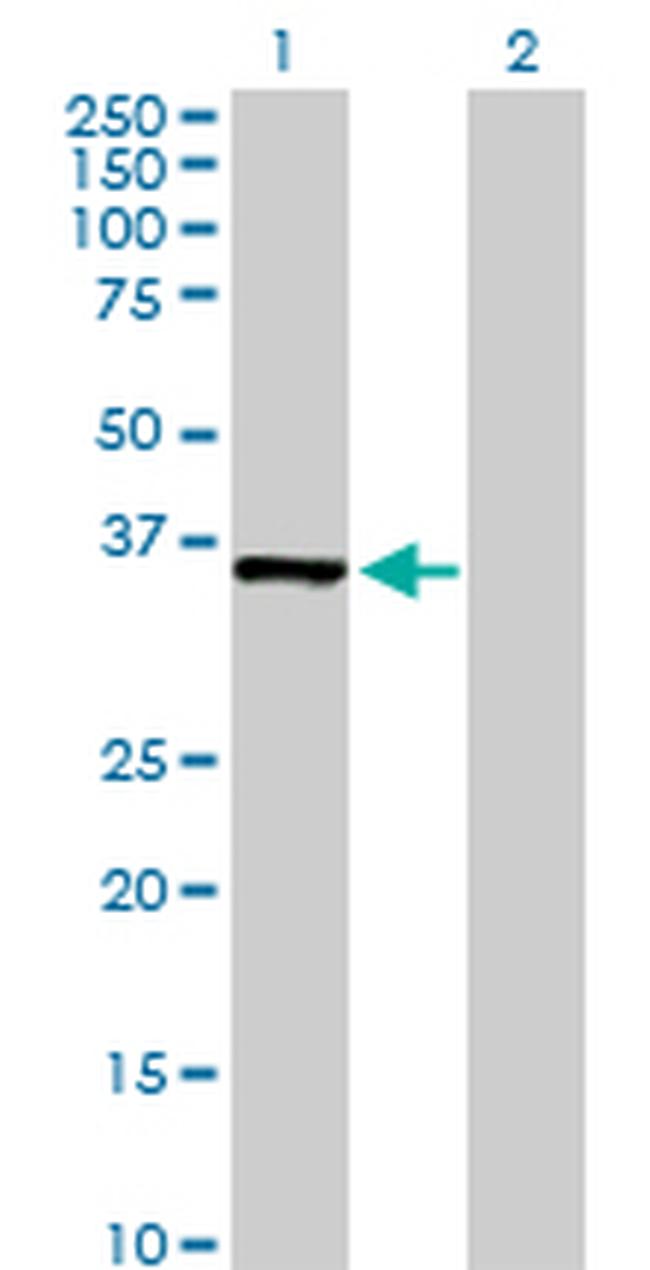 MDH1 Antibody in Western Blot (WB)