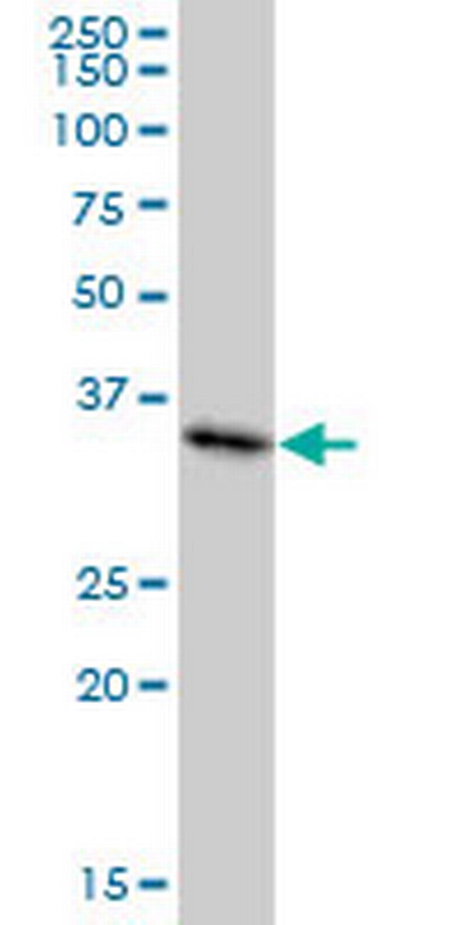 MDH1 Antibody in Western Blot (WB)