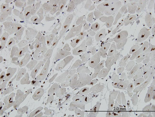 MECP2 Antibody in Immunohistochemistry (Paraffin) (IHC (P))