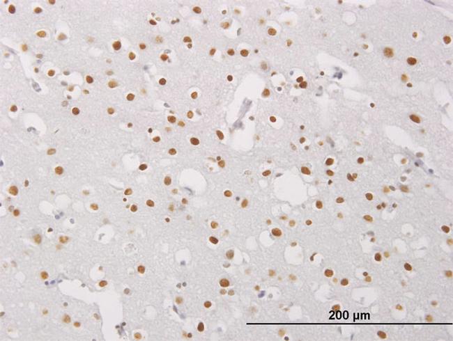 MECP2 Antibody in Immunohistochemistry (Paraffin) (IHC (P))