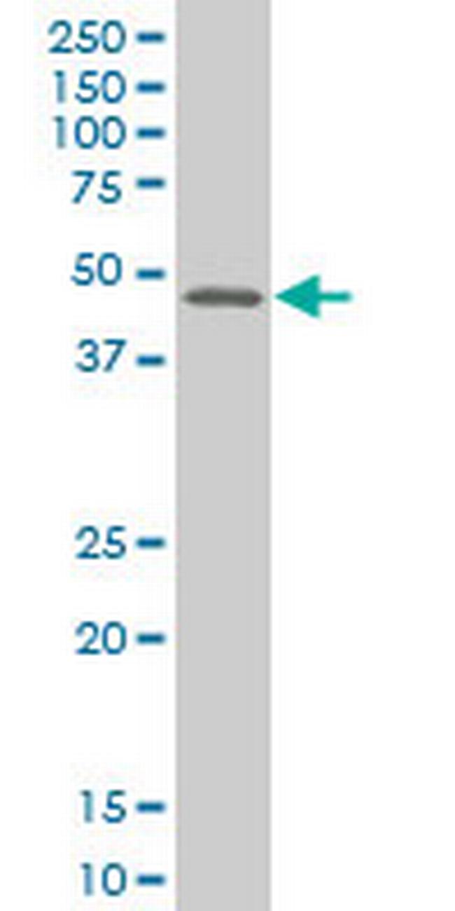 MEF2B Antibody in Western Blot (WB)