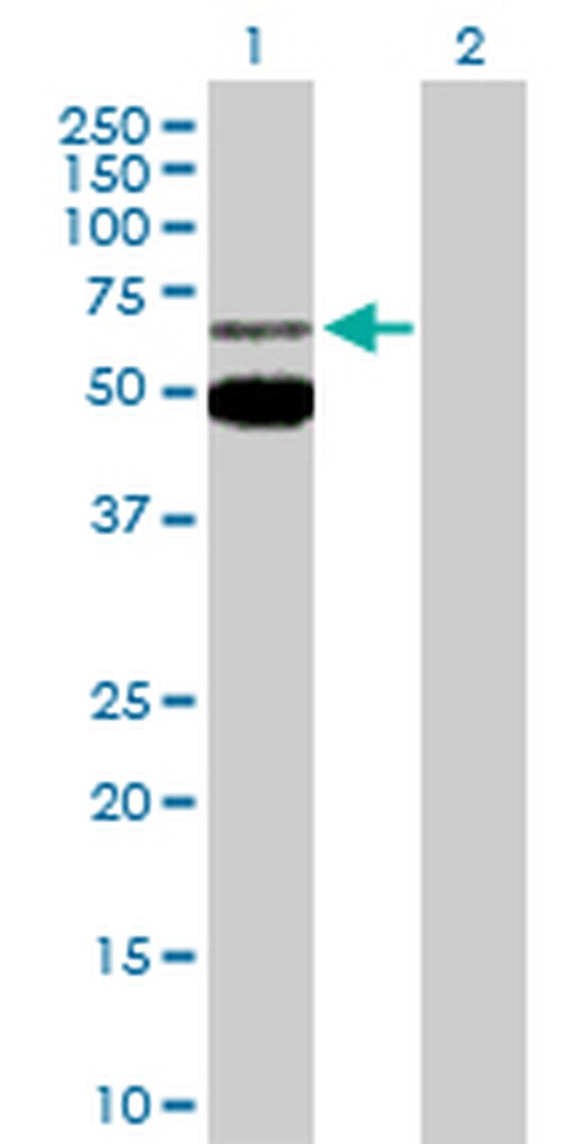 MEF2C Antibody in Western Blot (WB)