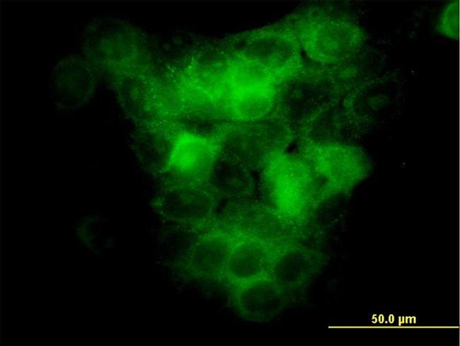 MAP3K5 Antibody in Immunocytochemistry (ICC/IF)