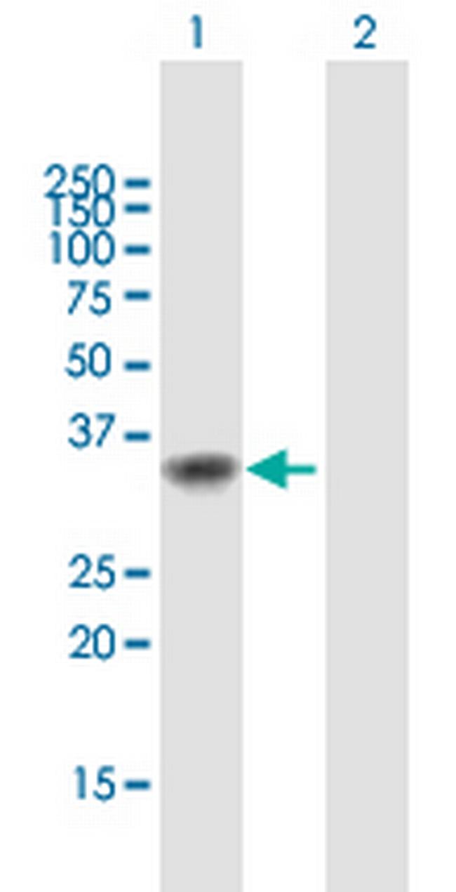 MEOX1 Antibody in Western Blot (WB)