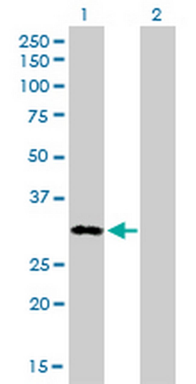 MEOX1 Antibody in Western Blot (WB)